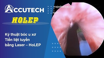 Kỹ thuật bóc u xơ Tiền liệt tuyến bằng Laser – HoLEP (bóc u)
