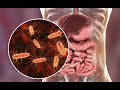 Research Update: Gut Bacteria and Multiple Sclerosis Webinar