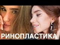 ПРОЩАЙ БОЛЬШОЙ НОС / Ринопластика / $ ЦЕНА на НОС, Мой Пластический Хирург