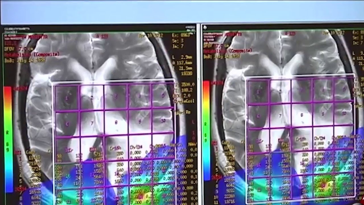 Don’t let these 4 myths about depression convince you that you’re making it up