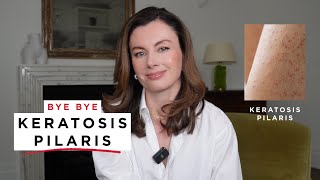 The Acid Body Wash You Didn’t Know You Needed | Keratosis Pilaris, Ingrown Hairs + Body Acne