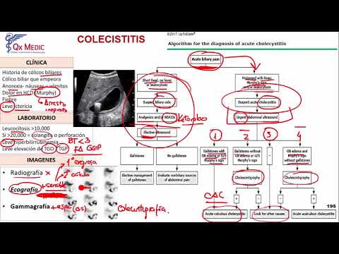 Colecistitis