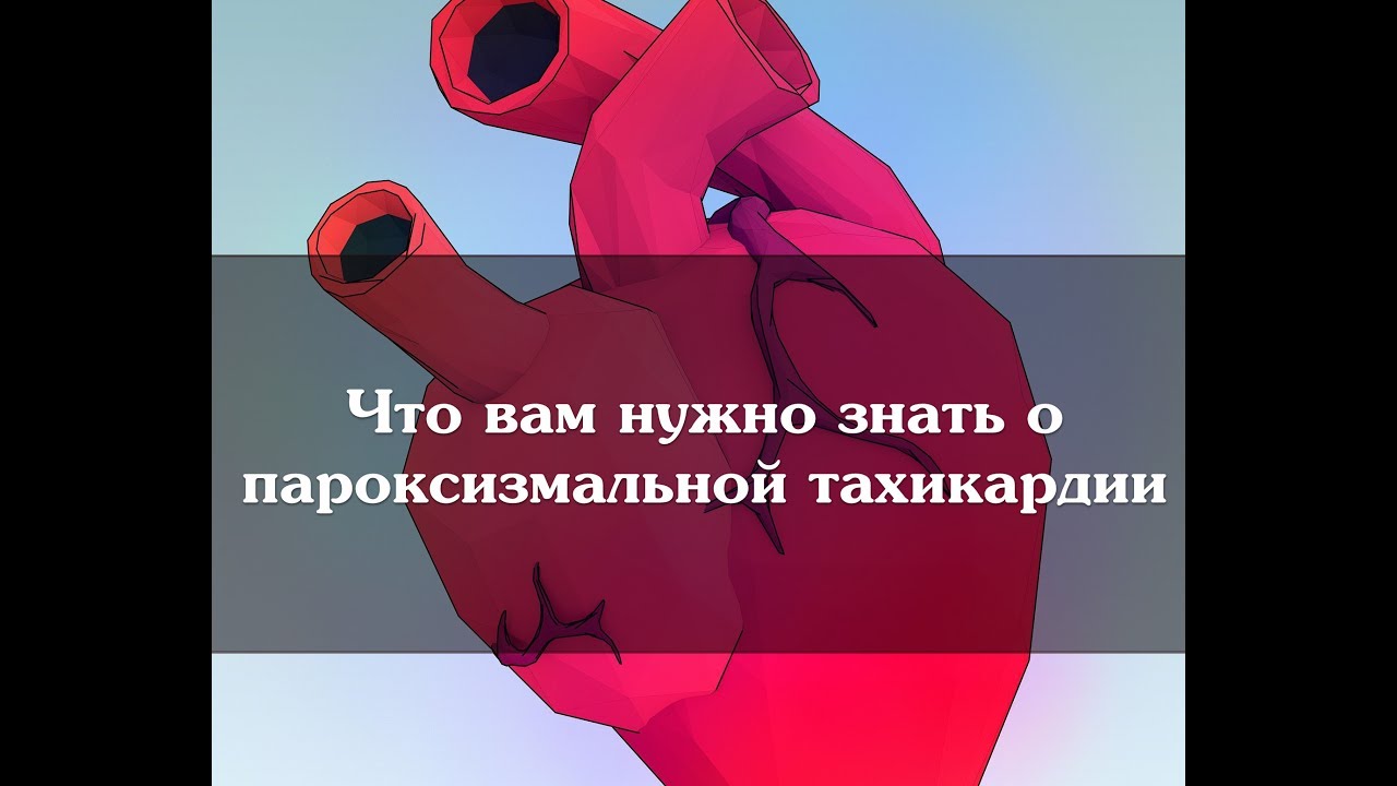Что вам нужно знать о пароксизмальной тахикардии