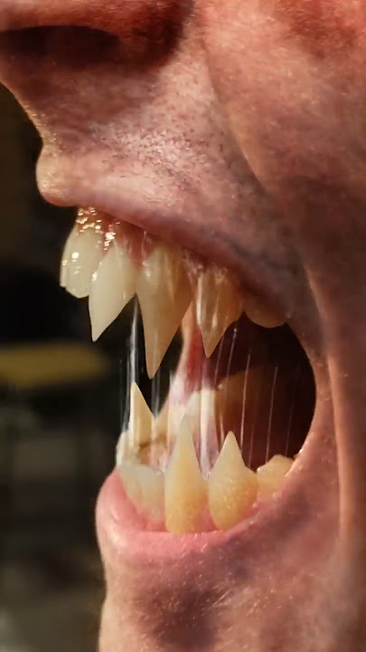 Werewolf attacks the set of Wolf Man