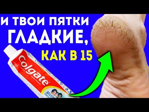 ПЯТКИ ГЛАДКИЕ, как в 15! Добавь в зубную пасту обычного... Трещины на пятках исчезнут!