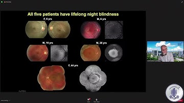 Role of electrophysiology in personalized medicine – by Prof. Graham E Holder