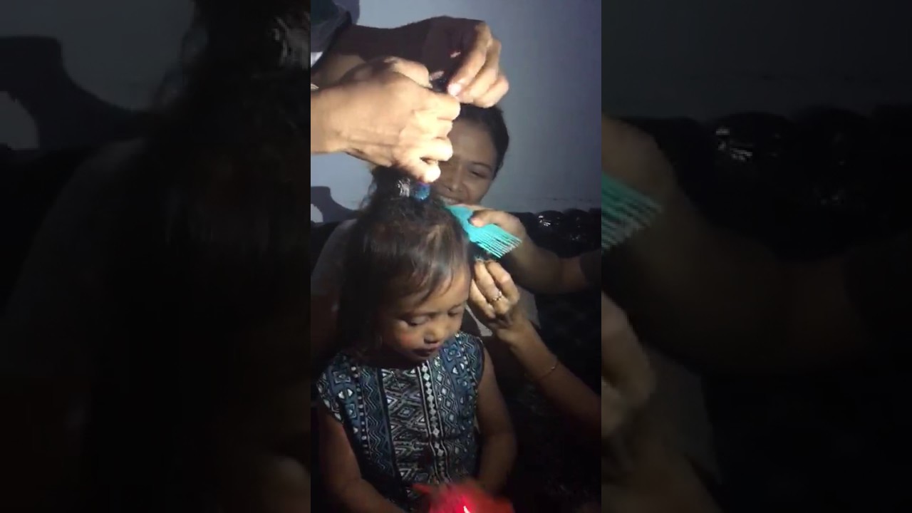 cara melepas bunchems / magic ball dari rambut