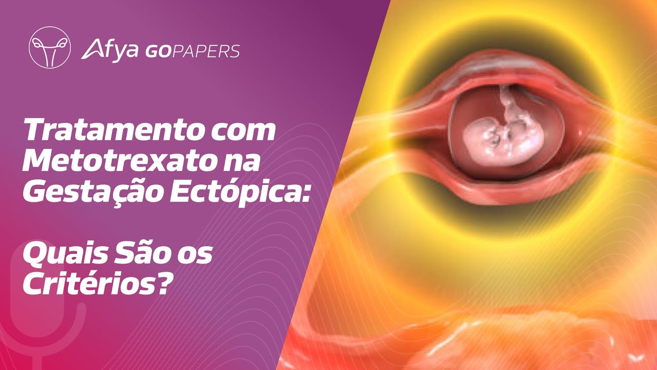 Tratamento com metotrexato na gestação ectópica: quais são os critérios ...