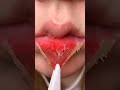 Peeling the skin of your lips  shorts lips lipshack peeling satisfying