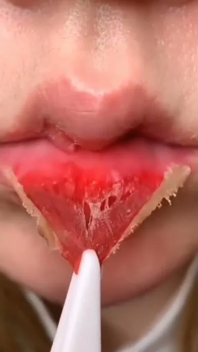 Peeling the Skin of your lips 😱😱 #shorts #lips #lipshack #peeling #satisfying