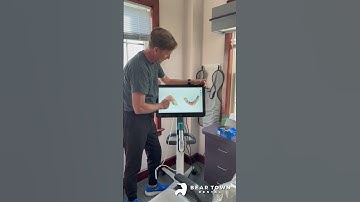 iTero Scanner | Bear Town Dental