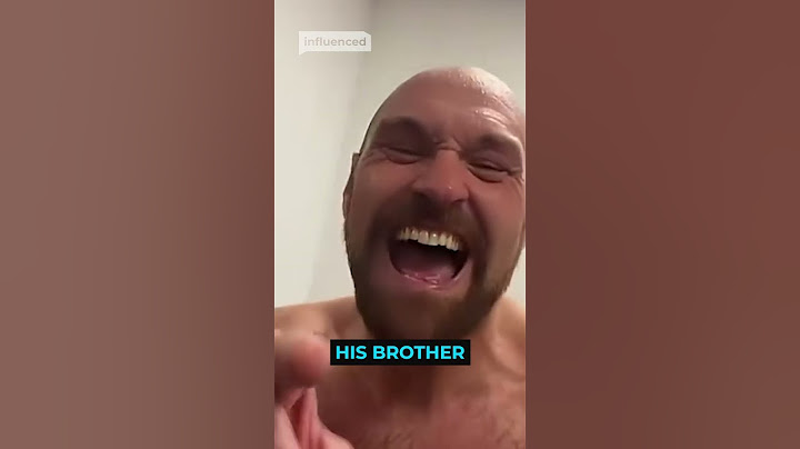 Tyson Fury Reacts To Losing Bet