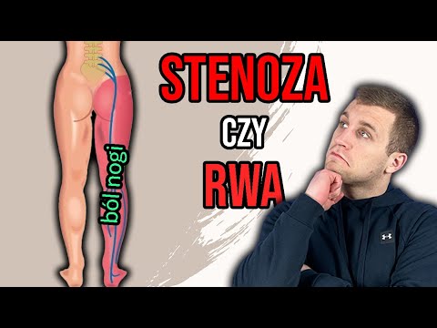 "Rwa kulszowa" vs Stenoza - różnice | *ból zespołu korzeniowego, chromanie neurogenne*