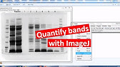 ImageJ for Editing & Labelling PCR Gel Image | Biotechnology ...