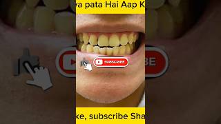 Daat ka asli Rang Kya Hai?  #facts #wowfacts #factsinhindi #factshorts