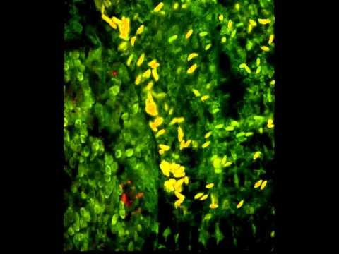 Vidéo: Hydroïde (méduse) : structure, reproduction, physiologie
