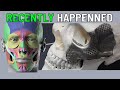 Shocking Breakthrough 3D Printed Artificial Bones Implanted In Human Body