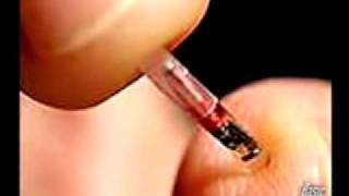 The Microchip: What Is It?