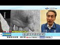 &quot;我下手太重&quot;安親師狂打童 &quot;沒交作業&quot;孕師棍棒毆童│中視新聞 20240529