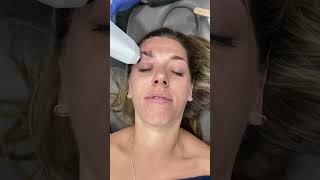 Doctor explains how to get a Non-Surgical Face Lift at Dr. Medispa screenshot 4