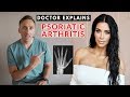 DOCTOR Explains Kim Kardashian's Arthritis Scare