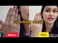 Hand's Care, remove darkness on knuckles, super soft hand, SHOCKING RESULT 😲
