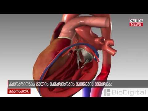 კაცობრიობას გულის უკმარისობის ეპიდემია ემუქრება