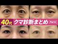 【保存版】40代からのクマ取り失敗しない選び方。湘南美容の最新症例から学ぶ、あなたに最適な施術とは?#クマ取り #クマ取整形 #目の下のクマ #クマ取りナビ #裏ハムラ #湘南美容クリニック
