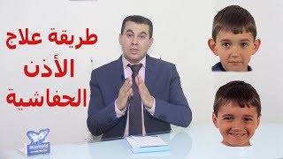 أفضل طرق التخلص من مشكلة الأذن الوطواطية عند الأطفال