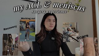 MY FULL ACL &amp; MENISCUS SURGERY EXPERIENCE: recovery process, advice, &amp; more!! (8 months post op)