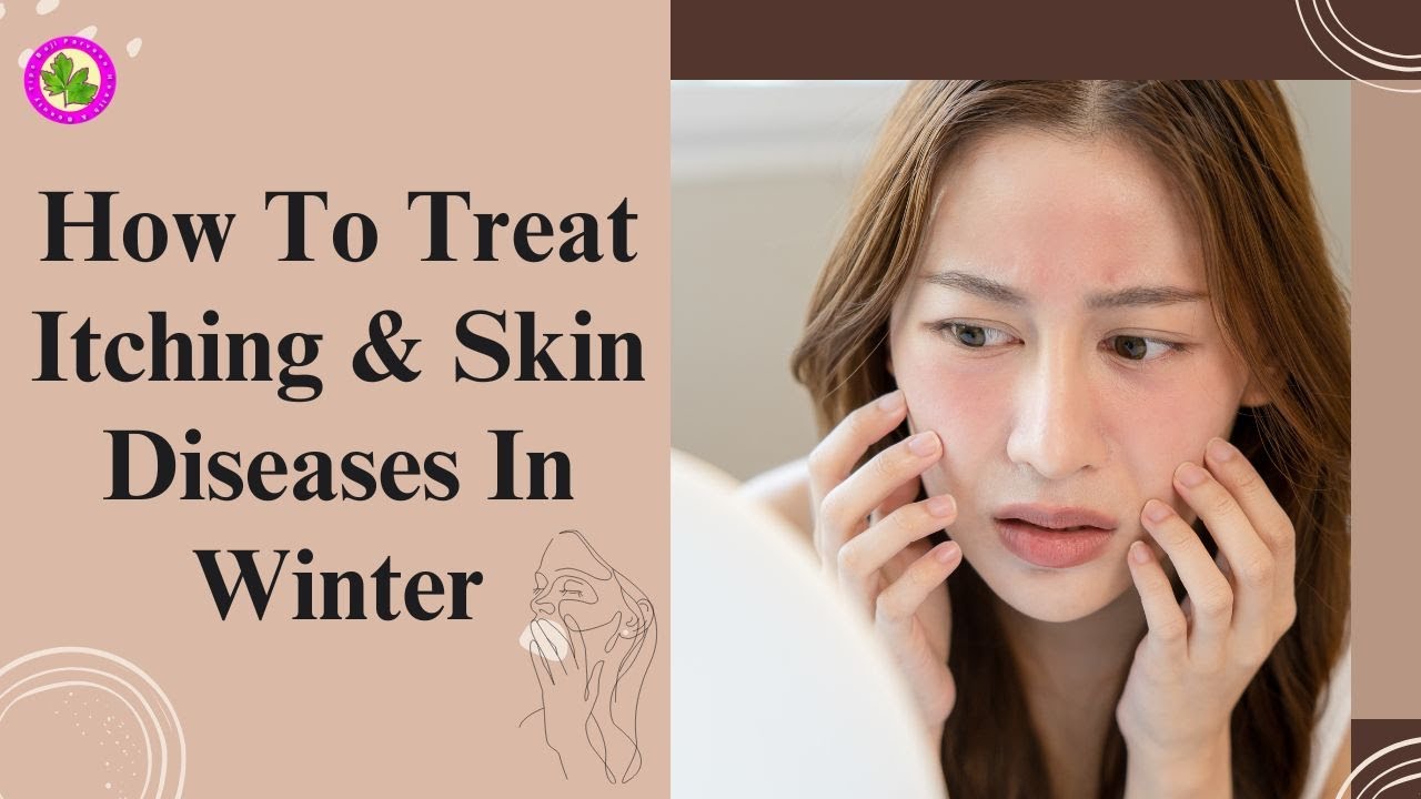 skin-allergy-in-winter-season-how-to-treat-itching-skin-diseases-in