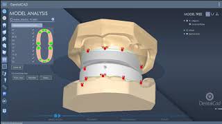 DentalCad 7.0 - New Features!