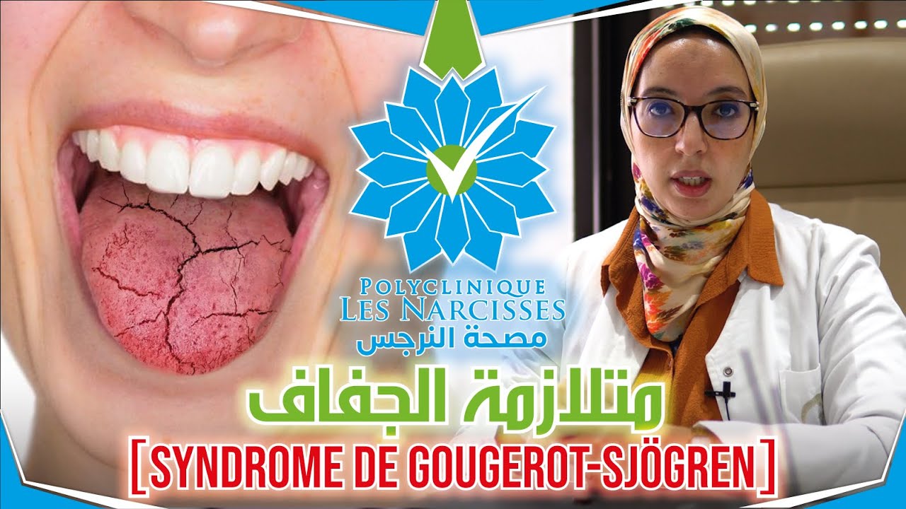 جفاف الجسم( متلازمة الجفاف) مع الدكتورة (سليمة ابو عثمان) Syndrome de Gougerot-Sjögren