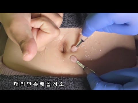 ASMR) Real Series   대리만족 배꼽청소_   Vicarious satisfaction belly button cleaning_   代理満足 へそ掃除 