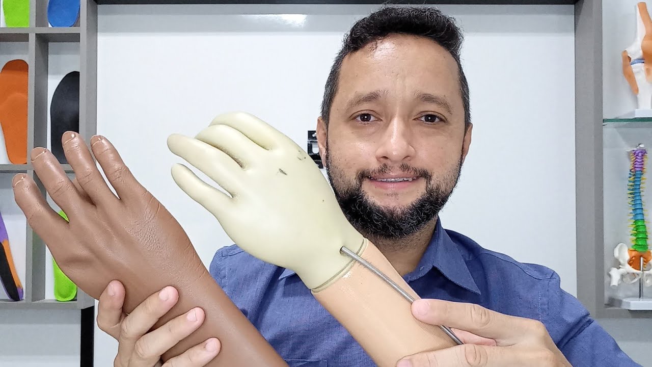 Luva cosmética que reveste a mão da prótese de membro superior - #braço #ottobock #hand