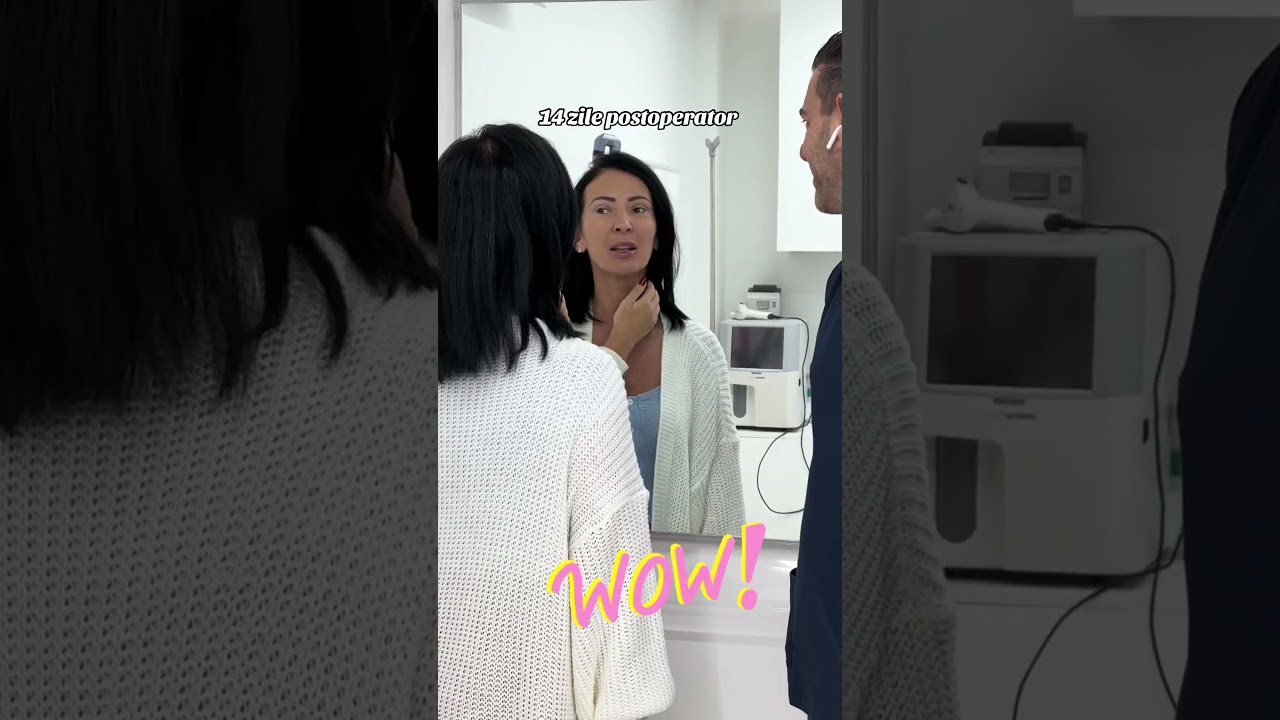 Cea mai frumoasă reacție pentru cel mai bun rezultat de la Blefaroplastie - Doctor Levy București