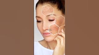 Remove Hyperpigmentation,dark spots,melazma|