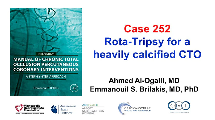 Case 252: Manual of CTO PCI - Rota-Tripsy for a heavily calcified CTO