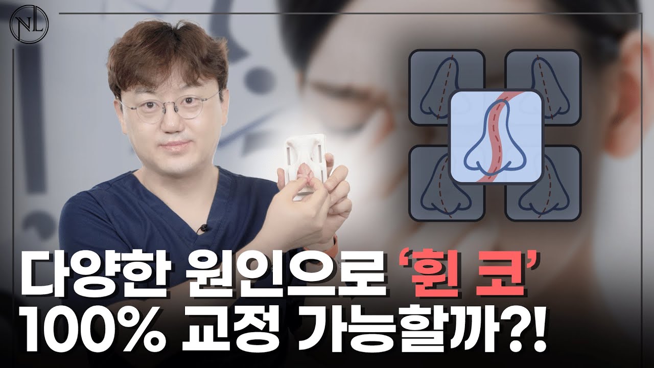 휜 코 유형별 수술 방법 완벽 가이드