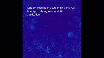 Calcium Imaging of AM Dyes Following Prolonged Incubation in Acute Neuronal Tissue
