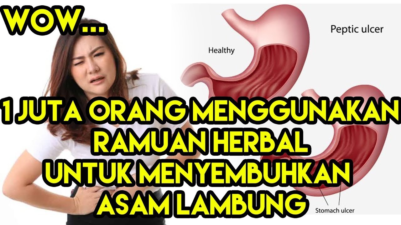 Cara Mengatasi Asam Lambung Yang Belum Diketahui