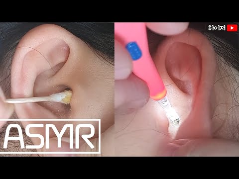 ASMR No Talking 리얼 엄마귀청소asmr 2탄 실제로 왕건 귀파기 귀마사지 Real Ear Cleaning Ear Massage