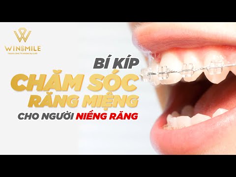 cách vệ sinh răng miệng cho người niềng răng tại Kemtrinam.vn