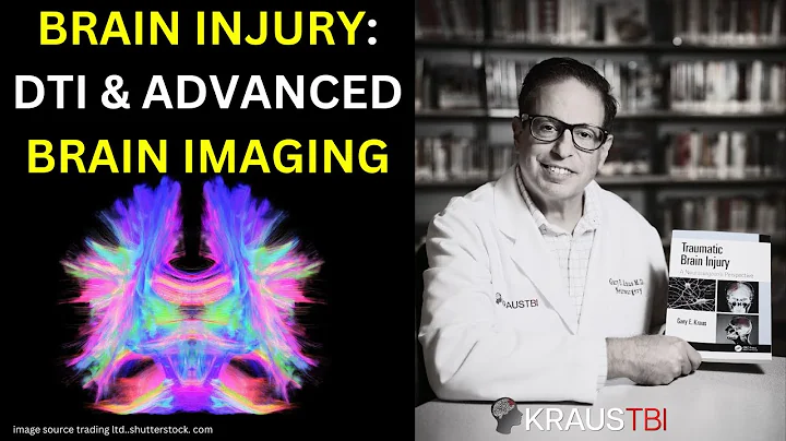 TRAUMATIC BRAIN INJURY: DTI & ADVANCED IMAGING BREAKTHROUGHS | Dr. Gary Kraus, Houston TBI Kraus TBI