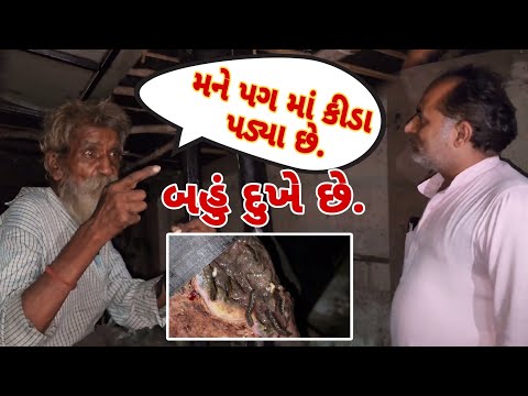 મને પગ માં કીડા પડ્યા છે🥺| આટલા બધા કિડા😱 #jaymanavsevaparivartrustnadiad #nadiad #youtube