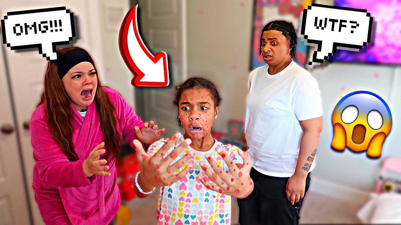 WAKING UP WITH 🐓POXS PRANK ON PARENTS **MUST WATCH** - YouTube