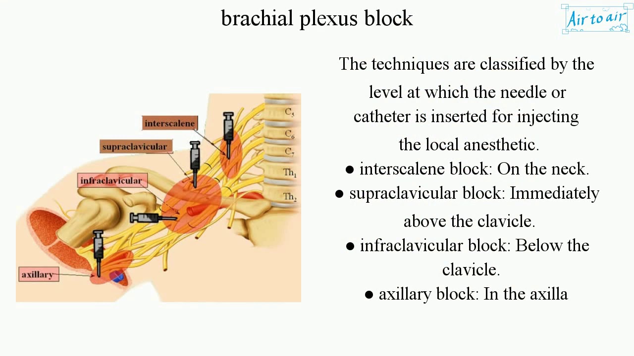 Brachial Plexus Block English Medical Terminology For Medical