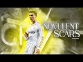 Cristiano Ronaldo Scars Novulent HD