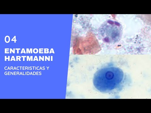 Entamoeba hartmanni 4.0 ||Parasitología || Amebas || Amebiasis intestinal