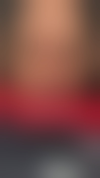 The Worst Injury in MMA History?